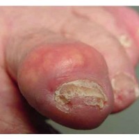 God Awful Morning: James Frey Is Killing My Toe