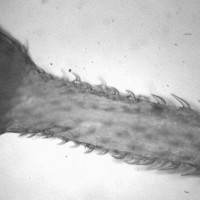 Intelligent Design Award: The Spiny-Headed Worm Parasite "Pomphorhynchus laevis"