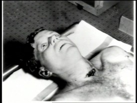 jfk-neck-wound jfk-neck-wound