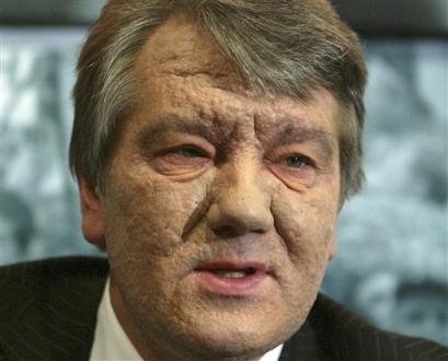 yushchenko1 yushchenko1