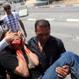 US citizen Emily Henochowicz was shot directly in the face with a tear gas canister as she non-violently demonstrated against the Flotilla massacre US citizen Emily Henochowicz was shot directly in the face with a tear gas canister as she non-violently demonstrated against the Flotilla massacre
