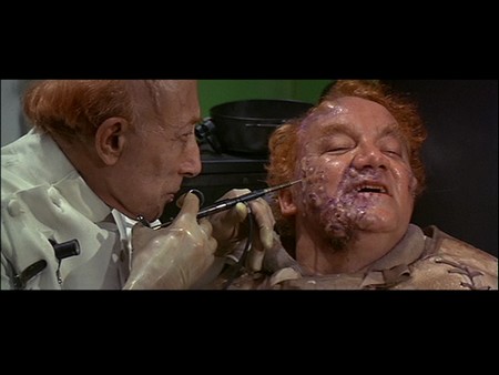 harkonnen-pustule-draining2