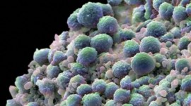 prostate cancer