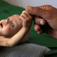 The War Nerd: Anglo-American Media Complicity in Yemen's Genocide